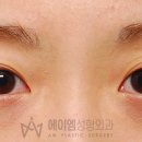 풀림