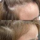 m헤어 | 마곡역 미용실 무제헤어샵, M자 이마 탈출기 잔머리펌 후기