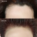 영수헤어라인
