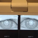 솔루나안경원 이미지