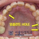 다정치과기공소 네이버블로그