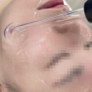 아진토탈케어 | 검단신도시 비비드엘 인천점에서 올인원 피부관리로 미백 잡티케어 한번에 하기