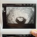 다나여성병원 | 7주6일차_초음파 후기 [다나여성병원 / 마미톡 / 얌얌이 첫 심장소리 들은 날]
