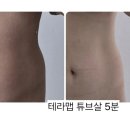 조이디바이스 이미지