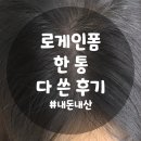 주네 | [탈모 극복기4탄] 로게인폼 한 통 다 쓴 후기 | 희망 주더니 쉐딩 주네?