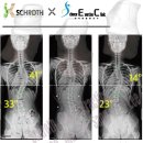 고려보조기 이미지