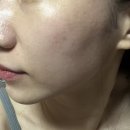 숲CALP | 안양피부관리 안양에스테틱 안양두피관리 석수동 숲칼프(숲 calp) 후기