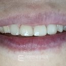 이세상치과기공소 이미지