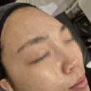 로덱스스킨