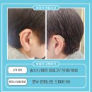 송보청기 | 대전 상대동 보청기,송XX고객님 포낙 인피니오 스피어 90 구매후기(70대,女)
