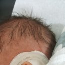 (주)제우스메드 | 아기귀 교정기 이어웰 사용후기 입니다