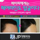 정 헤어라인 이미지