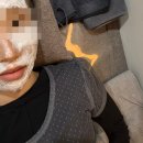 아이차 | [리쥬란 힐러/리쥬란 아이] 3회차 완료 후기│효과 기록 및 느낀 점