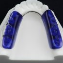 스타치과기공소 이미지