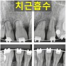 강서바른이치과교정과치과의원 이미지
