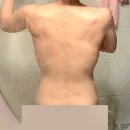 (주)팻라인 | 청담동피부과에서 이오팻주사로 체지방빼기 솔직후기(내돈내산)