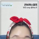부천SMP 헤어라인 교정 "리브레스칼프" 동그란 이마라인 만들기 후기