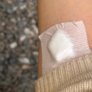 코앤핑이비인후과의원 | 수면다원검사 1 - 준비 비용 보험 실비 기본검사