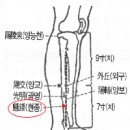 뜸의 비방책 이미지