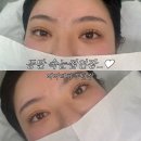 채영네일 | 동탄 속눈썹 비바터치 동탄점 LED 펌포인트 연장 채영쌤 시술후기