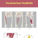 윤스피티 이미지