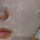 뽀얀피부 | 포항 피부관리 엑소좀 후기 – 비비뽀얀 포항북구점