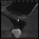 뿌리심는치과의원 이미지