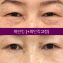 아이케이성형외과의원 네이버블로그
