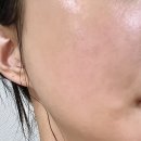 달메디 | 메디온다 재생크림 내돈내산 후기 라로슈포제 B5+와 제형 비교