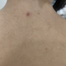 라인스킨 | 마곡 에스테틱 라인메이드 스킨케어 문제성피부관리 방문후기