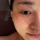 주식회사 라인건설 | 신촌 홍대마포피부관리 에스테틱 추천 고혹미 슈퍼젝션 블루 흑자 관리 2회차 후기