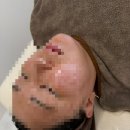 뷰티온의원평택고덕점 네이버블로그