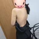 (주)모두메디칼 | 팔 지방 흡입 내돈내산 찐후기 | 1~2주 차 +압박복 추천 후기