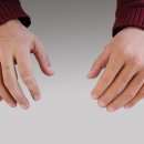 바른의수족제작연구소 이미지