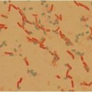 바실러스세레우스(Bacillus cereus)균의 특성 이미지