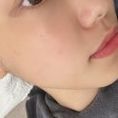 은별축산 | [원주 에스테틱]프리미엄 멀티 솔루션 케어 : 은별뷰티 피부관리 후기