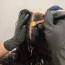 씨유 성남센터엠점 | 야탑두피 분당탈모 비듬 건성두피 관리 2개월차 후기 엠지에프두피탈모 전문센터 관리후기