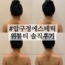 압구정 에스테틱 위뷰티압구정점 후기 | 비대칭 어깨 잡아준 승모근관리