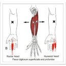 Flexor Digitorum Profundus (심지굴근) 이미지