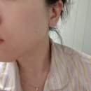 사과 | 미백앰플 추천｜아뉴브 사과세럼 후기 브라이트닝세럼 효과 솔직 정리