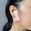 서울닥터윤이비인후과의원 | 이하선 종양 수술 후 흉터, 조직검사 결과, 수술비, 이하선 종양 보험금청구 땡큐서울의원 (4)