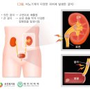 드림온피부비뇨기과 네이버블로그