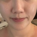 삼계 S라움테라피 얼굴 윤곽리프팅 관리후기