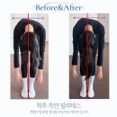 삼부프라자 | 척추측만 후기