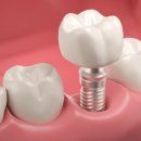 자연이바른치과의원 이미지