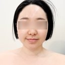 비칠영에스테틱