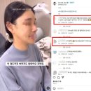 니트성형외과의원 | 여자코수술후기 얼굴과 완벽하게 어울리는 코