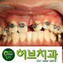 허브치과 티스토리