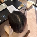 현암로89번길 | 정수리 탈모 고민 닷포유SMP 용인분당점에서 자신감 되찾은 솔직 후기!