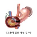 췌장암[Pancreatic cancer]종양혈액질환 이미지